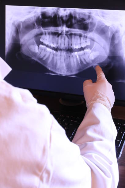 Best Emergency Treatment for Dental Infections or Abscesses in Fairview Park, OH