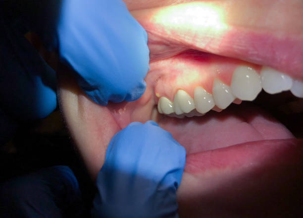 Best Emergency TMJ Treatment in Fairview Park, OH
