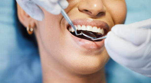 Best Emergency Treatment for Dental Infections or Abscesses in Fairview Park, OH
